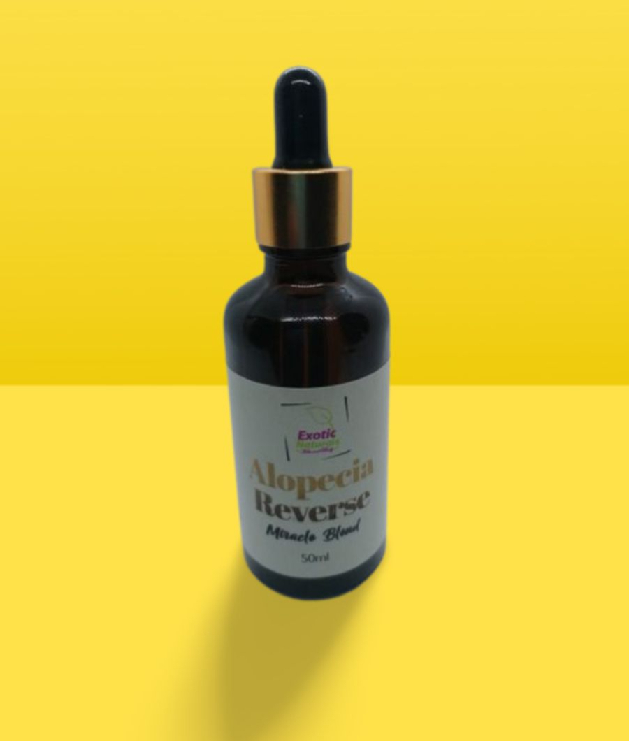 Alopecia Reverse1